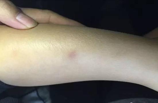 近日，有网友爆料称：天津市津南区一家幼儿园老师疑似用针扎孩子，并对孩子进行辱骂恐吓。微博 图
